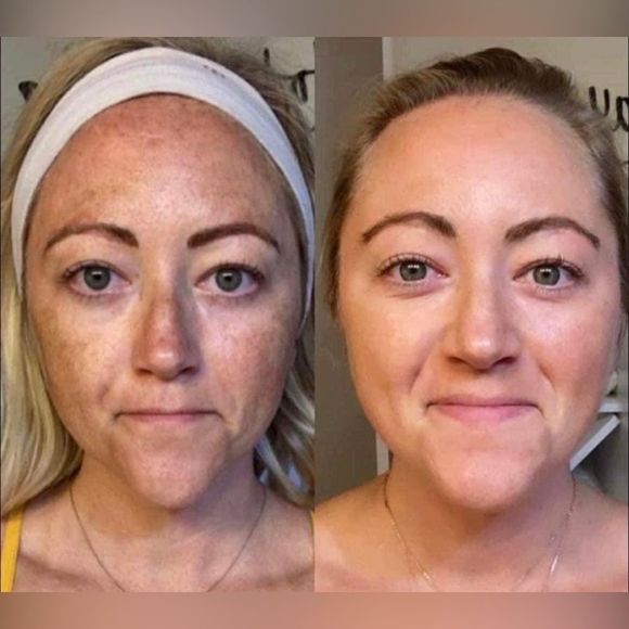 Two 180 Face Wash - Picture 4 of 14